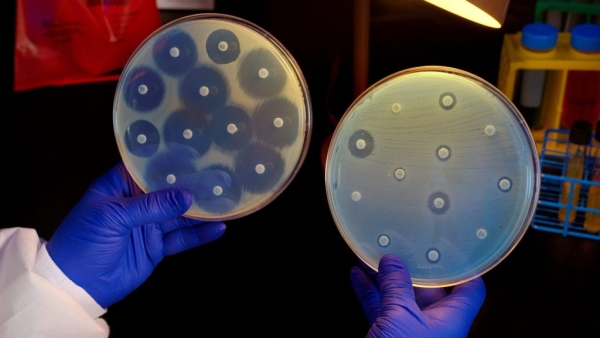 Na amostra à direita, Enterobacteriaceae resistente ao carbapenem pode ser capaz de crescer mesmo na presença de antibióticos