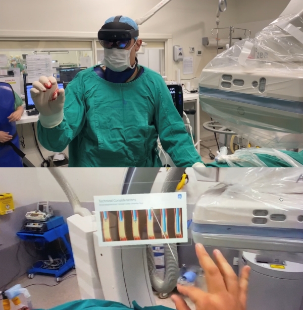 Procedimento inédito no Sul do país utiliza realidade virtual e laser para desobstrução de artéria_