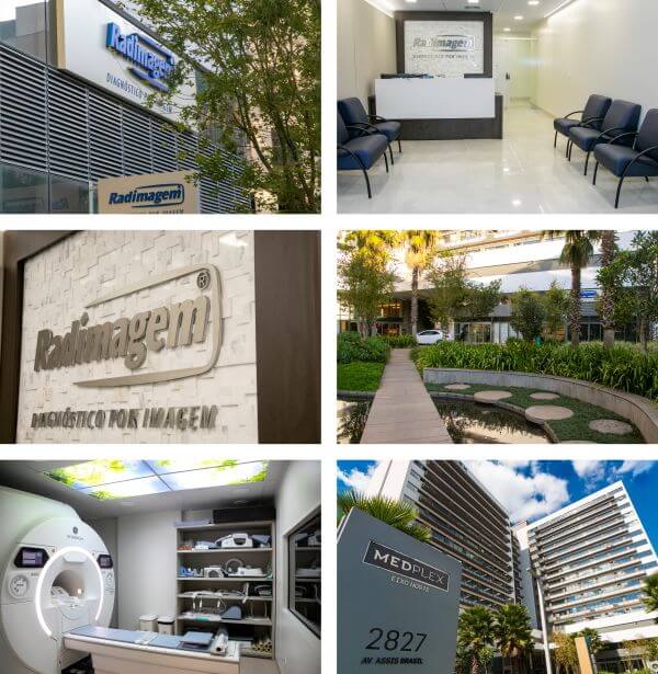 radimagem medplex assis brasil
