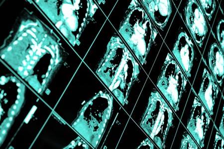 Tecnologia personalizada vai derrubar a relação médico-paciente