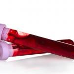 No futuro, exames de sangue poderão mostrar quem está curada do câncer de mama