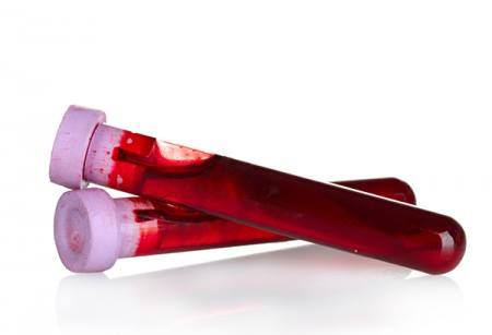 No futuro, exames de sangue poderão mostrar quem está curada do câncer de mama