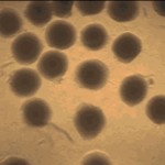 Esponja inteligente pode revolucionar tratamento de diabetes