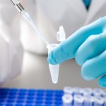 biopsia liquida
