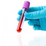 Anvisa lança Boas Práticas de Inspeção em Serviços de Hemoterapia