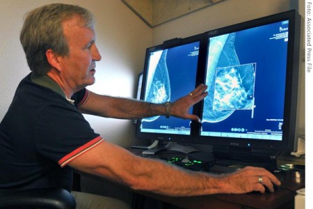 Estudo diz que mamografia 3D é mais eficiente para detectar câncer de mama