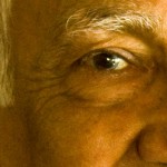 Glaucoma