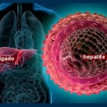 hepatite-virus