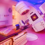 radioterapia