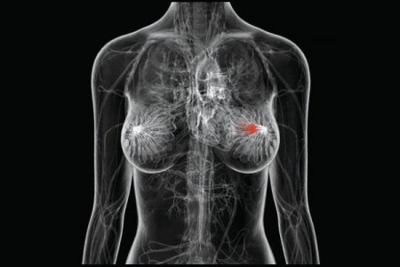 Número de mamografias no Brasil é três vezes menor do que o recomendado pela OMS