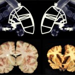 Estudos com jogadores de futebol americano confirmam danos cerebrais