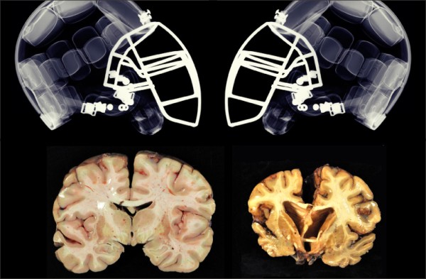 Regras do Futebol Americano da NFL - Guia Completo e Definitivo