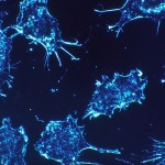 Nano robôs na luta contra o câncer