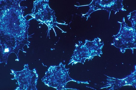 Nanotecnologia na luta contra o câncer