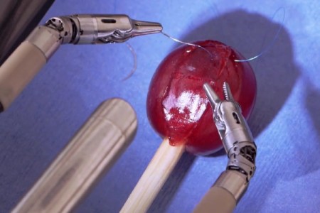 Veja como funciona o da Vinci, robô cirurgião de R$ 6 milhões