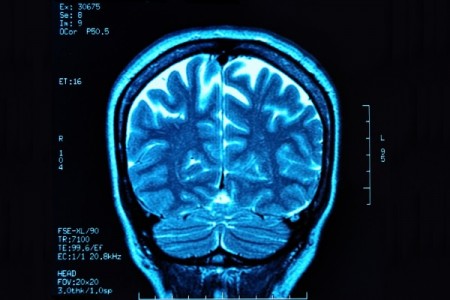 Anatomia do cérebro define se a pessoa é racional ou emocional