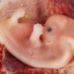 Como as células fetais agem no organismo das mulheres