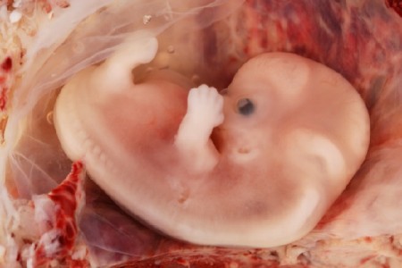 Como as células fetais agem no organismo das mulheres
