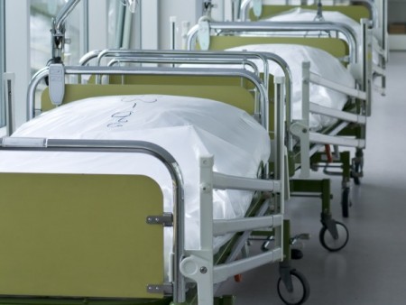 Alta incidência de sintomas e hospitalização após a cirurgia de bypass gástrico