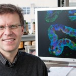 Células pancreáticas produtoras de insulina criadas a partir de células epiteliais humanas