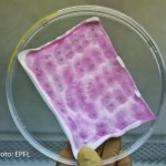 Bandagens de colágeno animal e células progenitoras tratam queimaduras e bactérias1