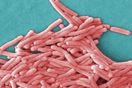 EUA anunciam guia de prevenção de Pneumonia causada pela bactéria Legionella