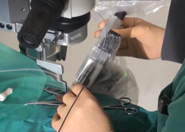Robô realiza a primeira cirurgia intraocular para restaurar visão