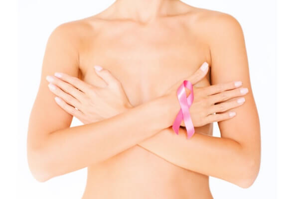 Tratamento com quimioterapia para o câncer de mama não é sempre o mais indicado