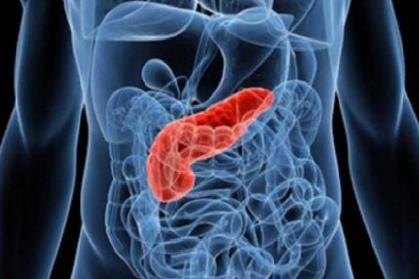 Câncer de pâncreas: novo teste para detecção precoce da doença