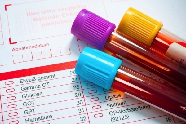 Primeiro exame de sangue para diagnosticar uma concussão é aprovado nos EUA