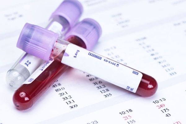 Novo exame de sangue poderá substituir biópsias desnecessárias para câncer de próstata