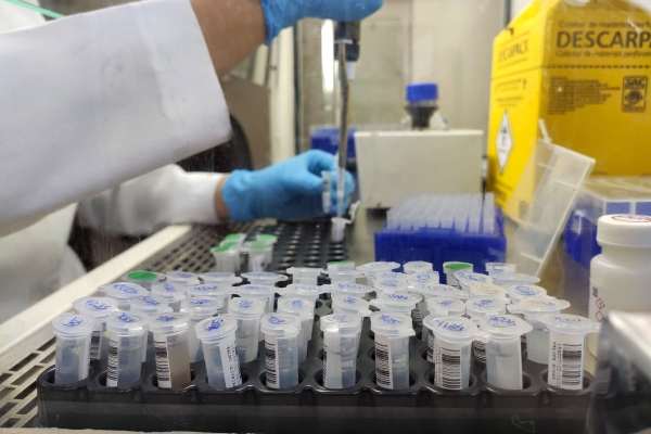 Laboratório da Santa Casa de Porto Alegre completa 10 anos e atinge mais de 40 mil exames de PCR para Covid