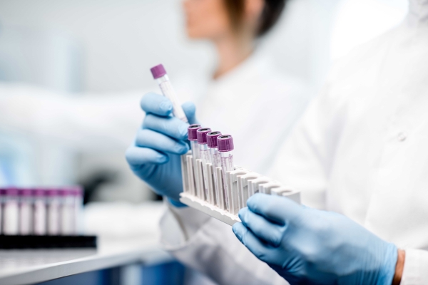 Teste molecular amplia diagnóstico de sífilis