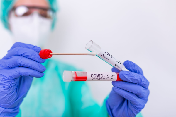 Exames de Covid-19 aumentam 200% em um mês, de acordo com Abramed
