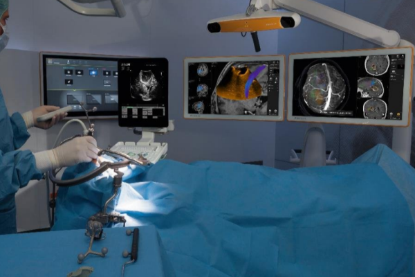 Ultrassom intraoperatório com imagem ativa auxilia no controle de ressecção de tumores durante cirurgias em tempo real