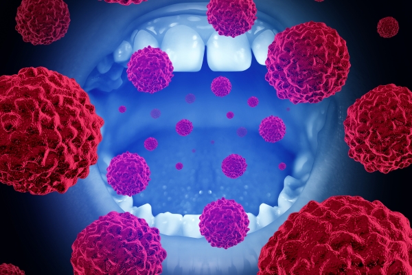 Três em cada quatro casos de câncer de boca e laringe são diagnosticados nos homens e em fase avançada