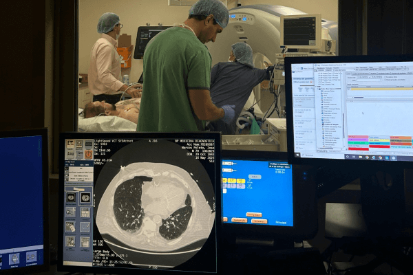 Crioablação BP realiza procedimento de excelência para tratamento de tumor desmoide