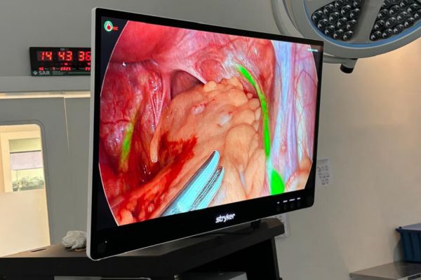 Tacchini investe em tecnologia cirúrgica de ponta e amplia segurança com torre de vídeo 4K com fluorescência